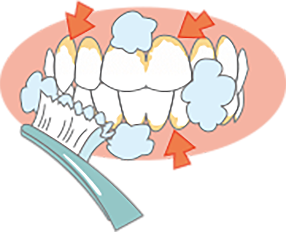 口腔内チェック