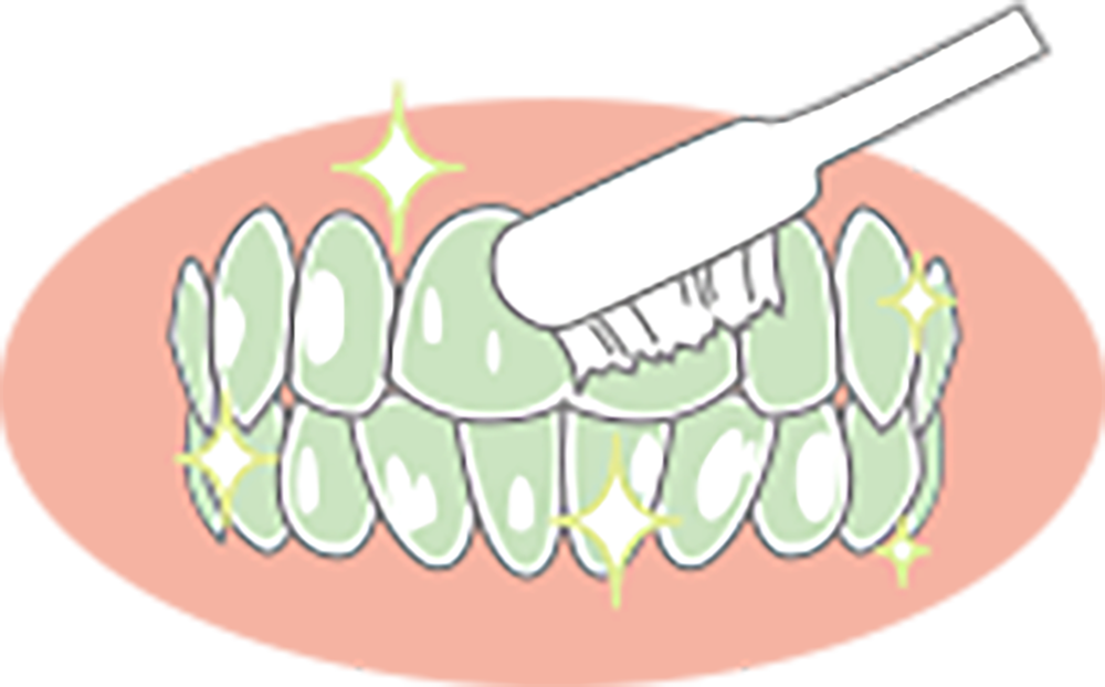 フッ素で歯質強化