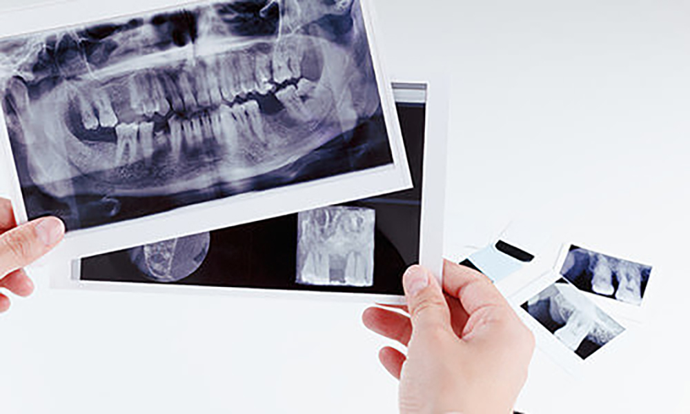 歯科口腔外科とは