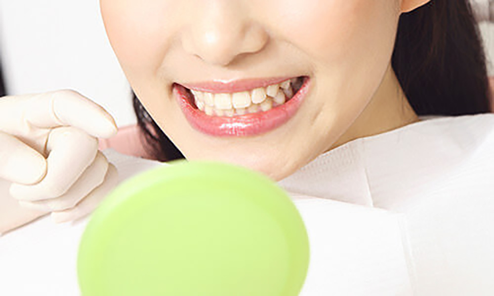 ホワイトニングとは